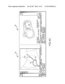 Method for producing an electrophysiological map of the heart diagram and image