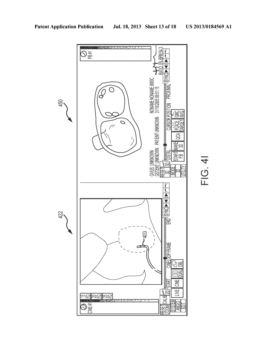 Method for producing an electrophysiological map of the heart - diagram, schematic, and image 14