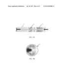 DETECTING A STENOSIS IN A BLOOD VESSEL diagram and image