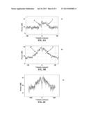 DETECTING A STENOSIS IN A BLOOD VESSEL diagram and image