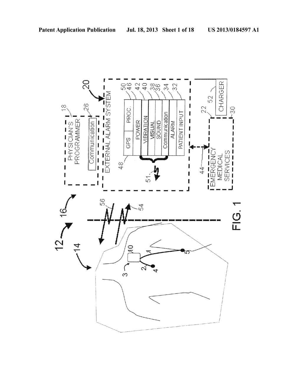 ACUTE ISCHEMIA DETECTION BASED ON PARAMETER VALUE RANGE ANALYSIS - diagram, schematic, and image 02