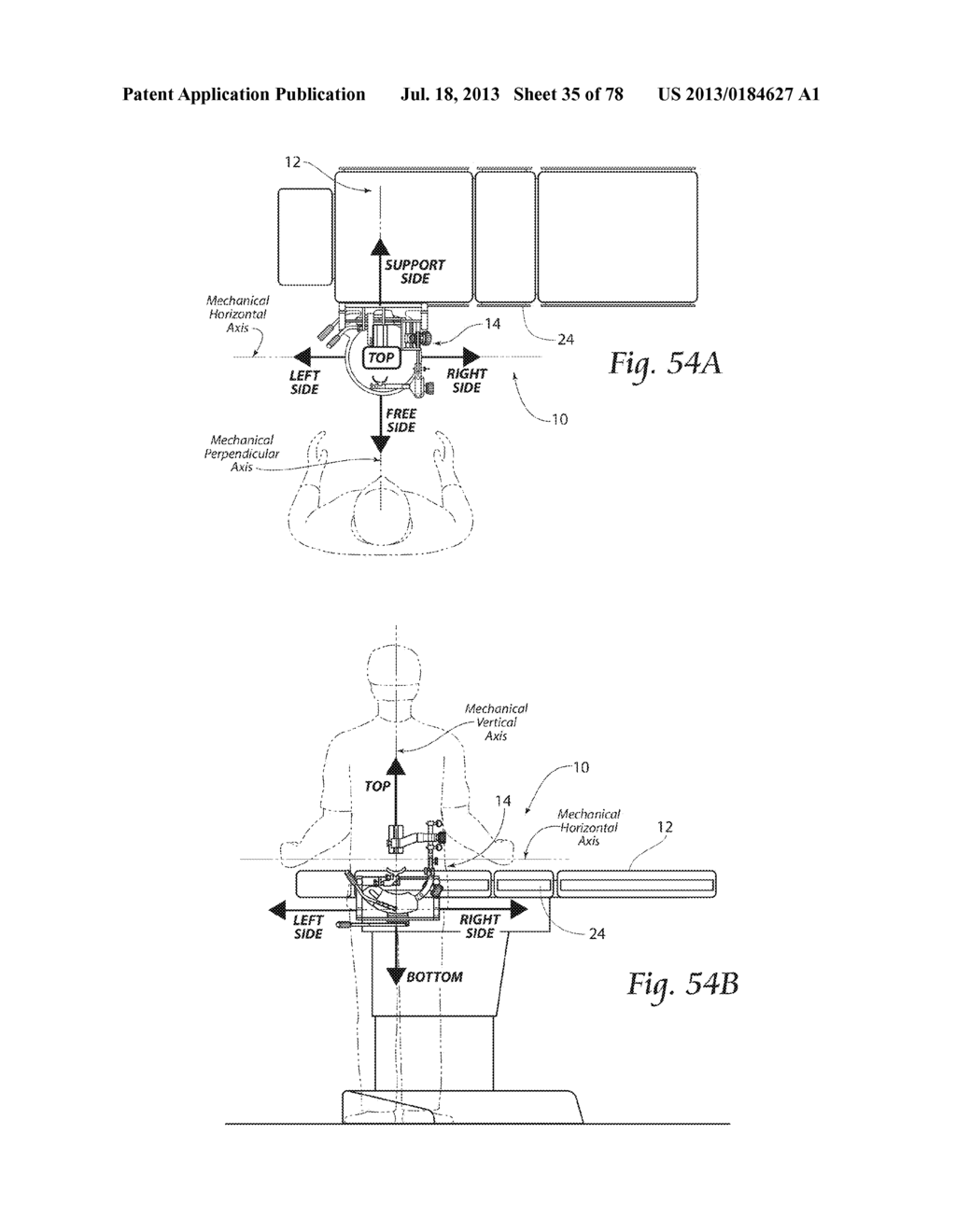 Systems, Devices, and Methods for Mechanically Reducing and Fixing Bone     Fractures - diagram, schematic, and image 36