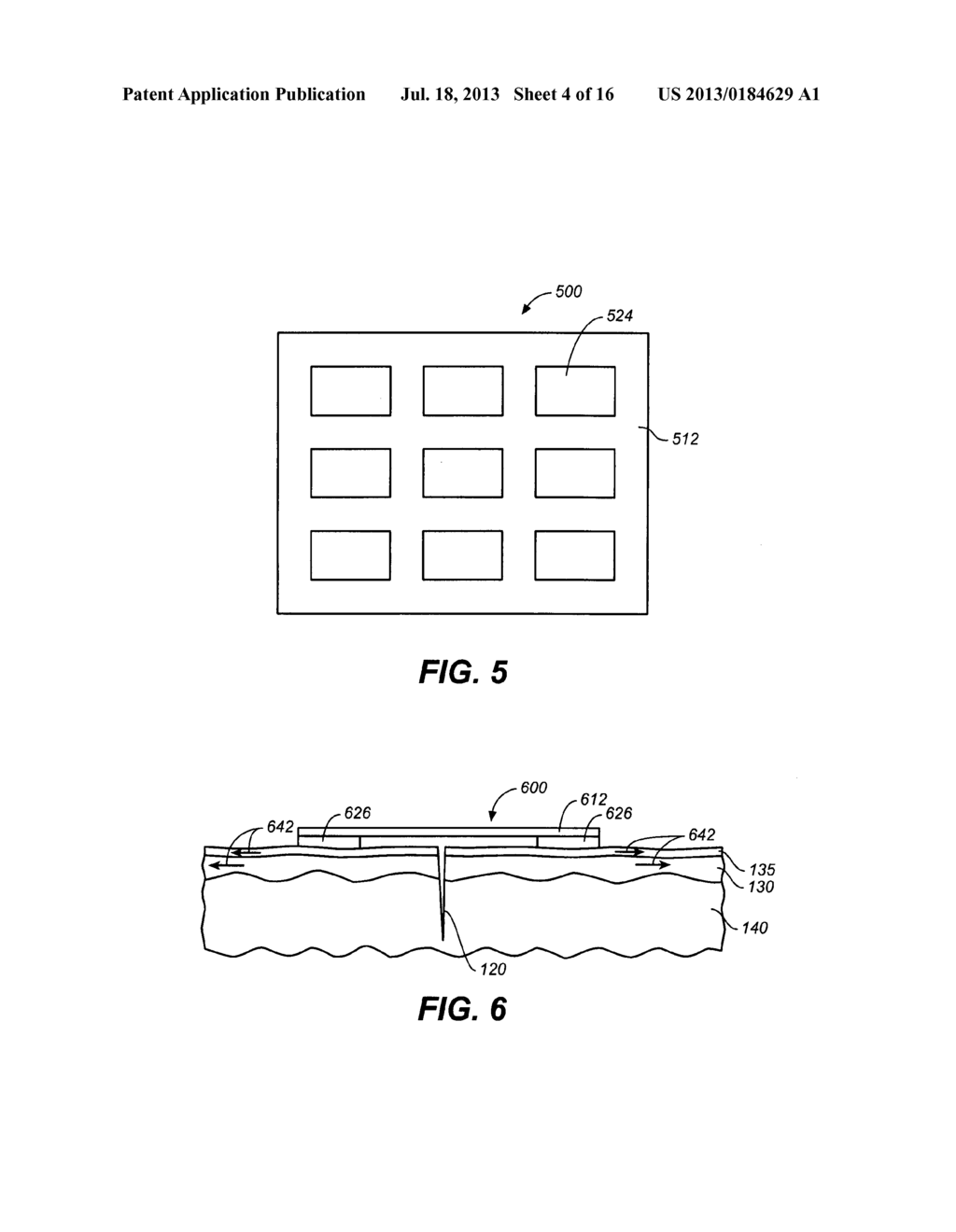 SKIN TREATMENT DEVICES AND METHODS WITH PRE-STRESSED CONFIGURATIONS - diagram, schematic, and image 05