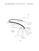 Method, Surgical Kit and Device for Treating Glaucoma diagram and image