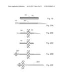 Method, Surgical Kit and Device for Treating Glaucoma diagram and image