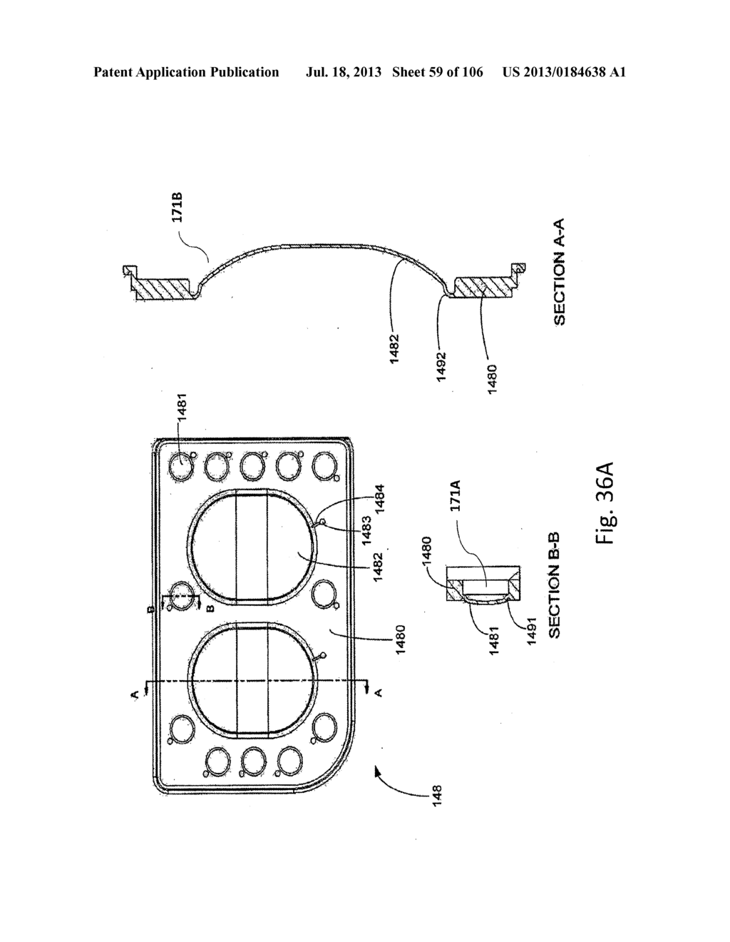 MEDICAL TREATMENT SYSTEM AND METHODS USING A PLURALITY OF FLUID LINES - diagram, schematic, and image 60