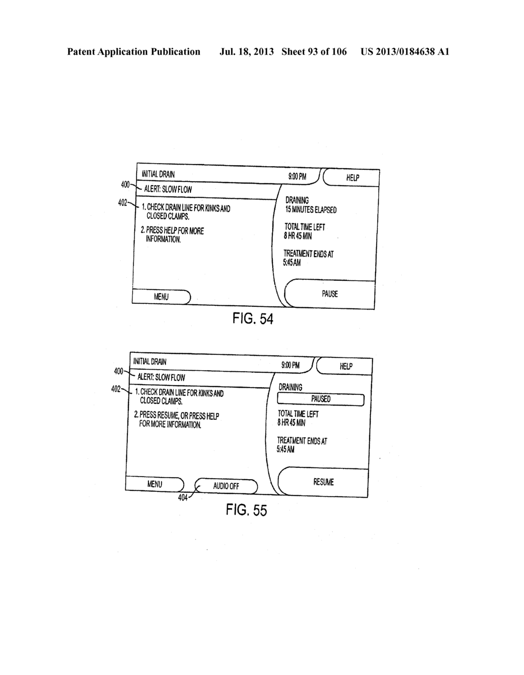 MEDICAL TREATMENT SYSTEM AND METHODS USING A PLURALITY OF FLUID LINES - diagram, schematic, and image 94