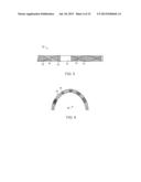 BALLOON CATHETER AND METHOD OF USE diagram and image