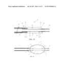 BALLOON CATHETER AND METHOD OF USE diagram and image