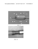 BALLOON CATHETER AND METHOD OF USE diagram and image