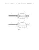 BALLOON CATHETER AND METHOD OF USE diagram and image