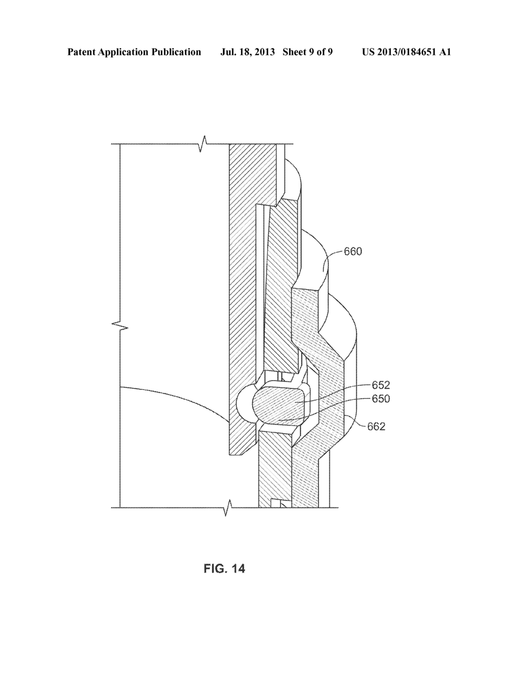 FLEXIBLE FASTENER FOR DRUG DELIVERY DEVICE - diagram, schematic, and image 10