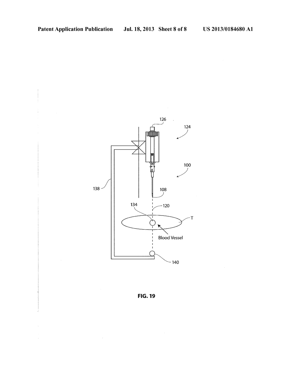 ASSISTIVE METHOD AND VISUAL-AID DEVICE FOR  VASCULAR NEEDLE INSERTION - diagram, schematic, and image 09