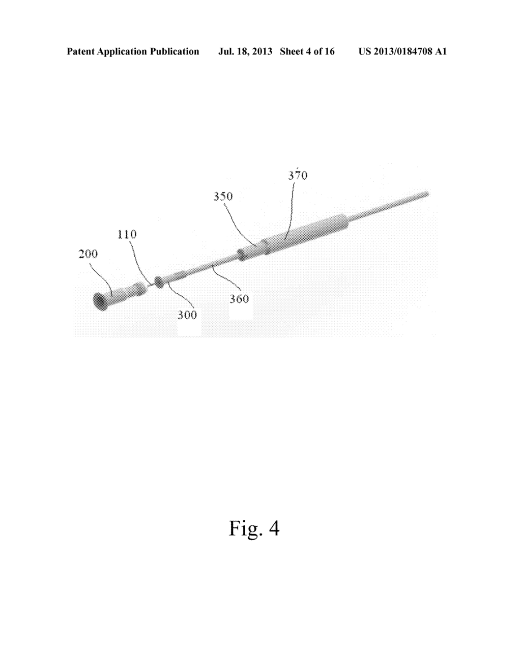 ORTHOPEDIC IMPLANT FOR TREATMENT OF BONE DEFORMITIES - diagram, schematic, and image 05