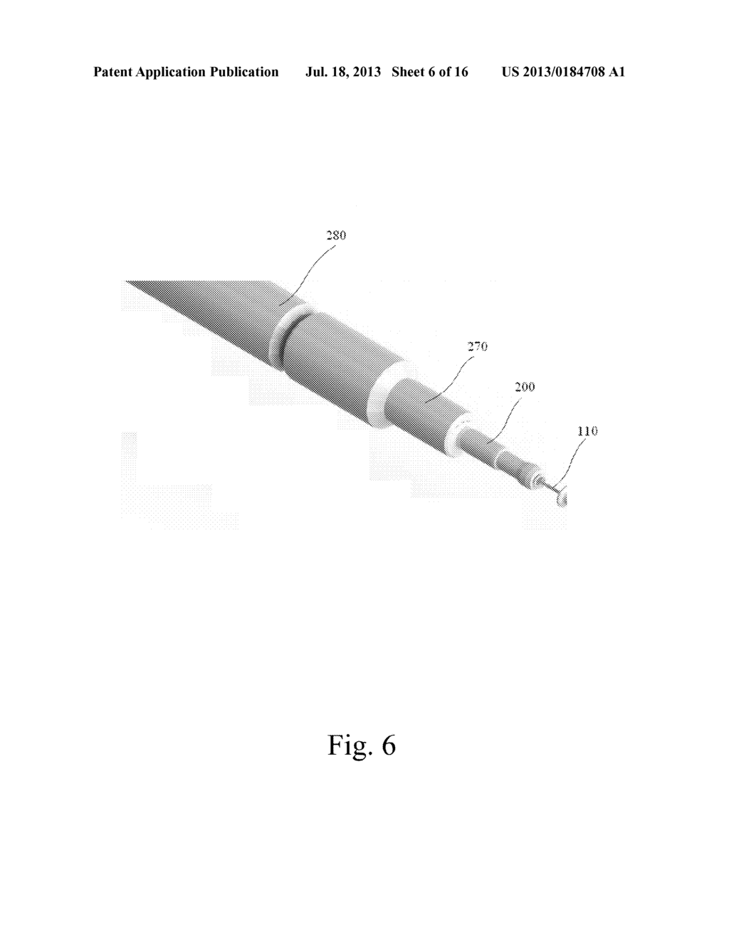 ORTHOPEDIC IMPLANT FOR TREATMENT OF BONE DEFORMITIES - diagram, schematic, and image 07