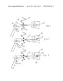 Volume Measuring Intervertebral Tool System and Method diagram and image