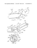 Volume Measuring Intervertebral Tool System and Method diagram and image