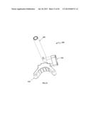 Anatomical Alignment Systems and Methods diagram and image