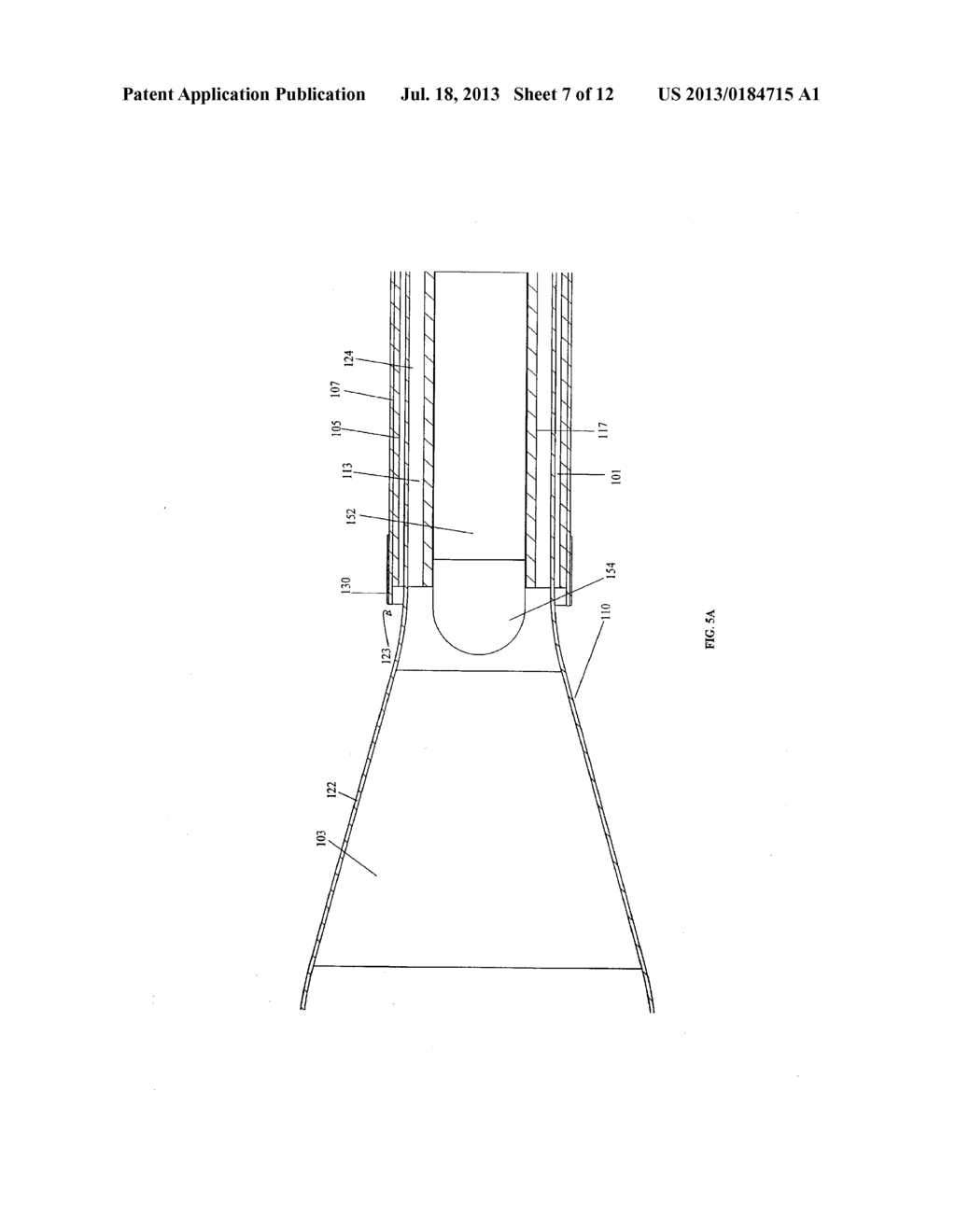 Systems and Methods for Internal Bone Fixation - diagram, schematic, and image 08