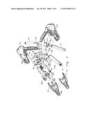 SURGICAL INSTRUMENT diagram and image