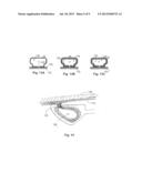 TISSUE-ACQUISITION DEVICE AND METHOD diagram and image