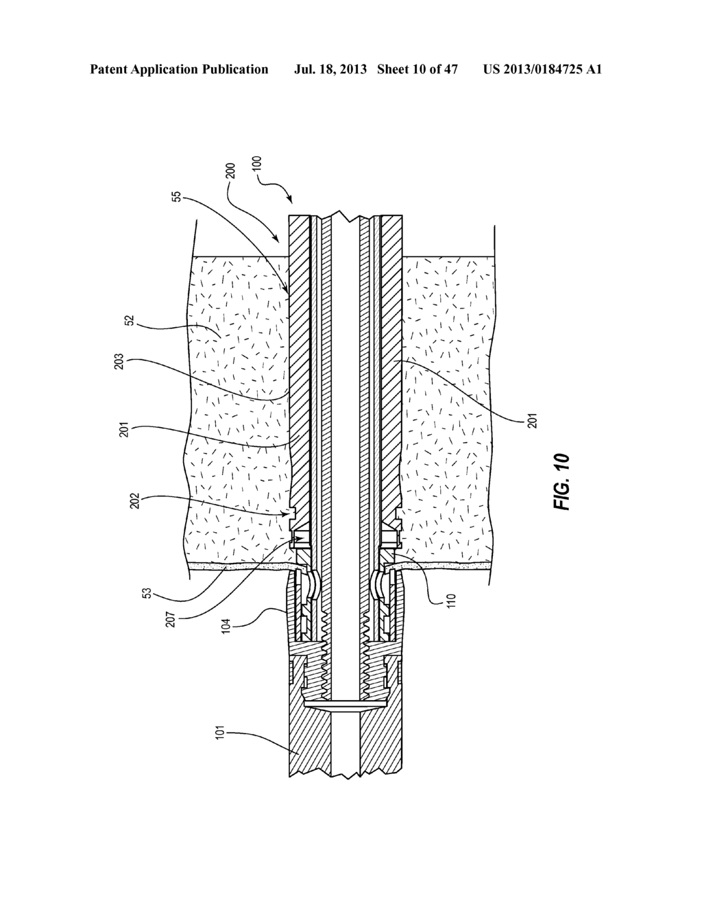 TISSUE MANAGEMENT APPARATUS FOR VASCULAR ACCESS - diagram, schematic, and image 11