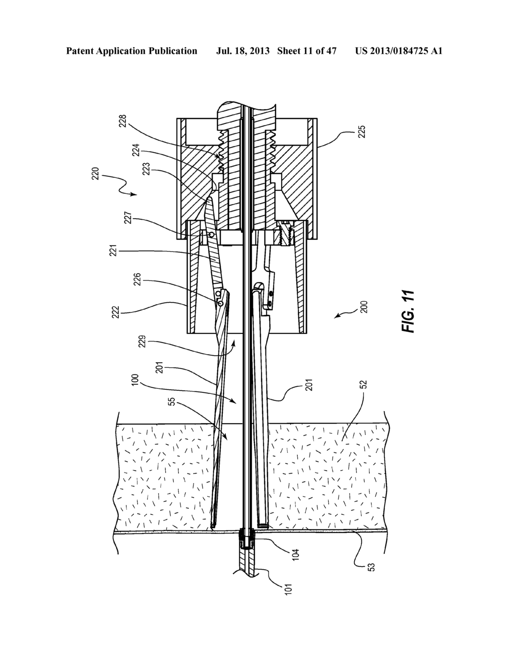 TISSUE MANAGEMENT APPARATUS FOR VASCULAR ACCESS - diagram, schematic, and image 12