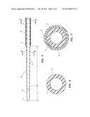 CAROTID SHEATH WITH ENTRY AND TRACKING RAPID EXCHANGE DILATORS AND METHOD     OF USE diagram and image