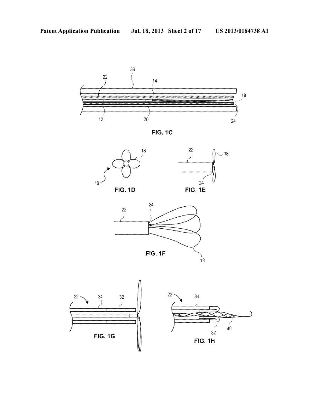 RETRIEVAL SNARE DEVICE AND METHOD - diagram, schematic, and image 03