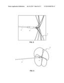 RETRIEVAL SNARE DEVICE AND METHOD diagram and image