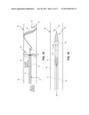 RETRIEVAL SNARE DEVICE AND METHOD diagram and image