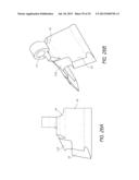 BONE ANCHOR SYSTEMS diagram and image