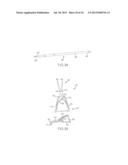 Telescoping Interspinous Fixation Device and Methods of Use diagram and image