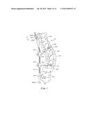 SEMI-CONSTRAINED ANCHORING SYSTEM diagram and image