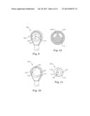 SEMI-CONSTRAINED ANCHORING SYSTEM diagram and image