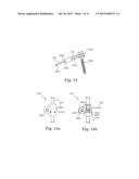 SEMI-CONSTRAINED ANCHORING SYSTEM diagram and image