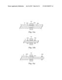 SEMI-CONSTRAINED ANCHORING SYSTEM diagram and image