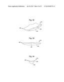 LOW-PROFILE, UNIPLANAR BONE SCREW diagram and image