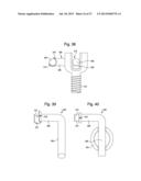 LOW-PROFILE, UNIPLANAR BONE SCREW diagram and image