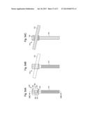 LOW-PROFILE, UNIPLANAR BONE SCREW diagram and image