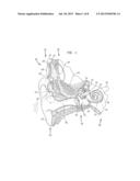 DIRECTIONAL SOUND PROCESSING IN A COCHLEAR IMPLANT diagram and image