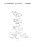 IMPLANTABLE COMPONENT INTERFACE diagram and image