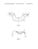 COMPUTER-IMPLEMENTED METHOD FOR DIGITALLY DESIGNING A DENTAL RESTORATION     AND A COMPUTER-READABLE MEDIUM diagram and image