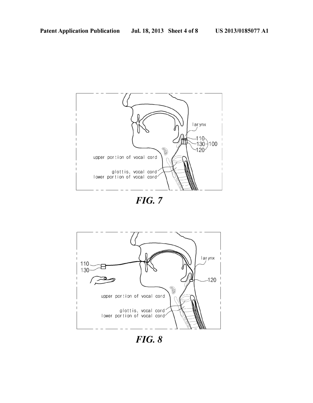 DEVICE FOR SUPPLEMENTING VOICE AND METHOD FOR CONTROLLING THE SAME - diagram, schematic, and image 05