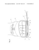 SOLE FOR SHOES HAVING ONE OR MORE VERTICAL ELEMENTS FOLDED OVER EACH     OTHER, EXTENSIBLE AND ADAPTABLE TO THE DIFFERENT WIDTH OF THE ASSEMBLY     LAST OF THE UPPER AND TO THE VARIATION OF THE CONFORMATION OF THE FOOT,     EVEN PERMANENTLY diagram and image