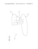 IMPLANT SYSTEMS AND METHODS FOR TREATING OBSTRUCTIVE SLEEP APNEA diagram and image