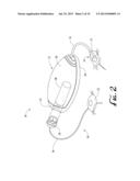 RESERVOIR PRESSURE EQUALIZATION SYSTEMS AND METHODS diagram and image