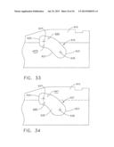 SURGICAL STAPLING DEVICE WITH A CURVED CUTTING MEMBER diagram and image