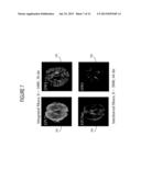 System for Motion Corrected MR Diffusion Imaging diagram and image