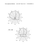 MULTILEVEL ANTENNAE diagram and image